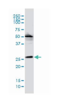 VPS25, Mouse, Clone: S2, Abnova 200&mu;L; Unlabeled:Antibodies, Monoclonal