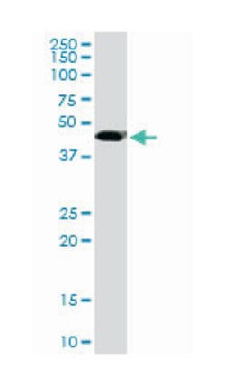 transcriptional adaptor 2 (ADA2 homolog, yeast)-beta, Mouse, Clone: 1C8,