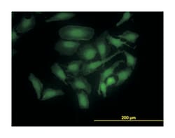 PDZ binding kinase, Mouse, Clone: 3A11, Abnova 100&mu;g; Unlabeled:Antibodies,
