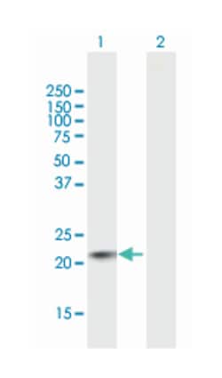 RAB22A, member RAS oncogene family, Mouse, Polyclonal Antibody, Abnova