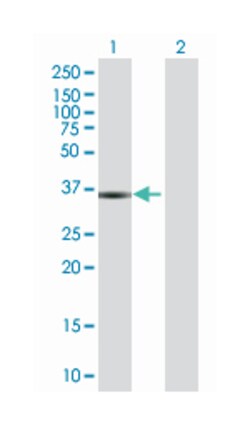 THO complex 6 homolog (Drosophila), Mouse, Polyclonal Antibody, Abnova