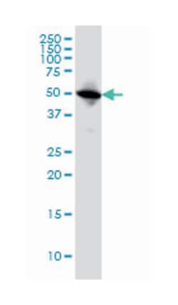 tubulin, alpha 1c, Mouse, Clone: S11, Abnova 100&mu;g; Unlabeled:Antibodies,