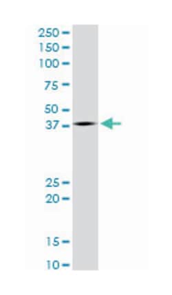 LIM homeobox 4, Mouse, Clone: 4D7, Abnova 100 &mu;g | Buy Online | Abnova | Fisher Scientific