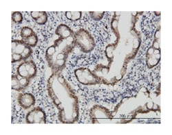 checkpoint with forkhead and ring finger domains, Mouse, Clone: 1H3-A12,