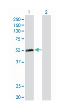 testis expressed 13A, Rabbit, Purified MaxPab Polyclonal Antibody, Abnova 100 &mu;g | Buy Online | Abnova Corporation | Fisher Scientific