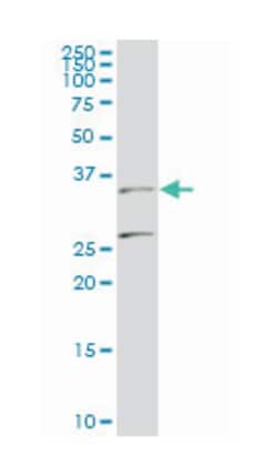 BarH-like homeobox 1, Mouse, Clone: 2B11, Abnova 100&mu;g; Unlabeled:Antibodies,