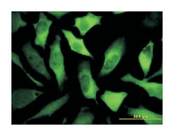 DPYSL5, Mouse, Clone: 2D10, Abnova 100&mu;g; Unlabeled:Antibodies, Monoclonal