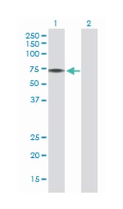 PINK1 (D01P), Rabbit anti-Human, Polyclonal Antibody, Abnova 100&mu;g;