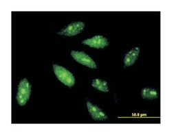 tripartite motif-containing 56, Mouse, Clone: 4C5, Abnova 100&mu;g; Unlabeled:Antibodies,