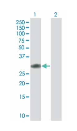 coiled-coil domain containing 88B, Mouse, Polyclonal Antibody, Abnova 50 &mu;L | Buy Online | Abnova | Fisher Scientific