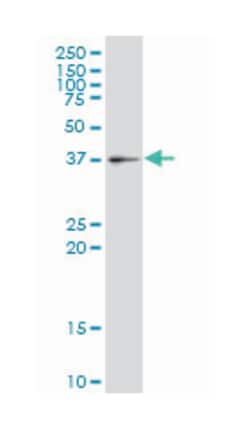 GTPase, IMAP family member 4, Mouse, Polyclonal Antibody, Abnova 50 &mu;L | Buy Online | Abnova Corporation | Fisher Scientific