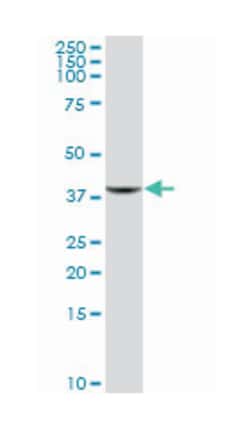 GTPase, IMAP family member 4, Mouse, Purified MaxPab Polyclonal Antibody, Abnova 50 &mu;g | Buy Online | Abnova Corporation | Fisher Scientific