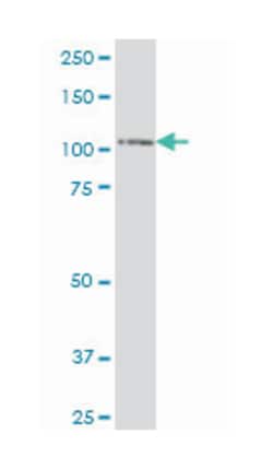 SRY (sex determining region Y)-box 6, Mouse, Polyclonal Antibody, Abnova
