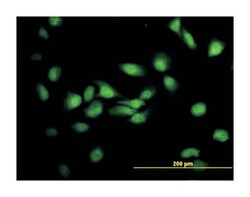 integrin alpha FG-GAP repeat containing 2, Mouse, Clone: 3D4, Abnova 100 &mu;g | Buy Online | Abnova | Fisher Scientific