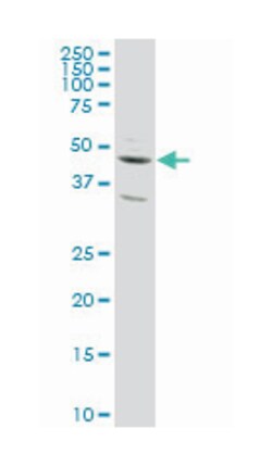 SLC2A4 regulator, Mouse, Clone: 4C10, Abnova 100 &mu;g | Buy Online | Abnova Corporation | Fisher Scientific