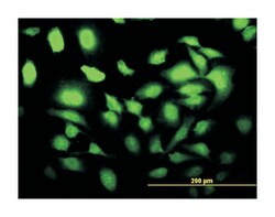 SLC2A4 regulator, Mouse, Clone: 4C10, Abnova 100 &mu;g | Buy Online | Abnova Corporation | Fisher Scientific