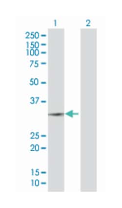 mitochondrial ribosomal protein S35, Mouse, Polyclonal Antibody, Abnova