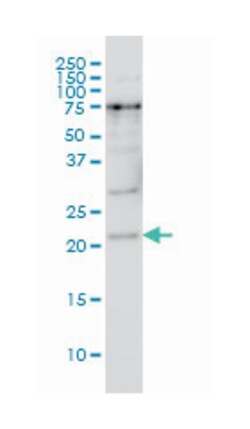 PRKR interacting protein 1 (IL11 inducible), Mouse, Clone: 4D11-3F11, Abnova
