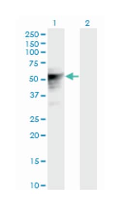 transducin-like enhancer of split 6 (E(sp1) homolog, Drosophila), Mouse,