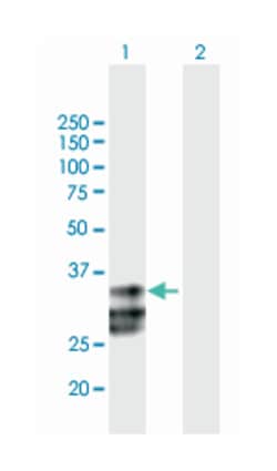 ULBP2, Mouse, Purified MaxPab Polyclonal Antibody, Abnova 50&mu;g; Unlabeled:Anticuerpos