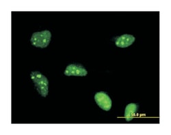 polymerase (RNA) I polypeptide B, 128kDa, Mouse, Clone: 4H6, Abnova 100&mu;g;