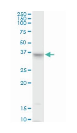 THOC3, Mouse, Polyclonal Antibody, Abnova 50 &mu;g | Buy Online | Abnova Corporation | Fisher Scientific
