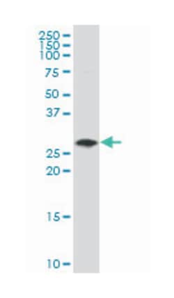 polycomb group ring finger 1, Mouse, Polyclonal Antibody, Abnova 50μL;