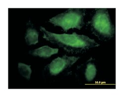 CABLES1, Mouse, Purified MaxPab Polyclonal Antibody, Abnova 50&mu;g; Unlabeled:Antibodies,