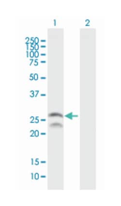 FEV, Mouse, Purified MaxPab Polyclonal Antibody, Abnova 50&mu;g; Unlabeled:Anticuerpos