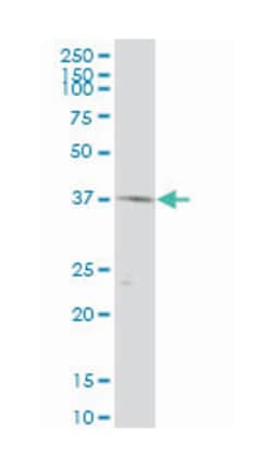 PIN2-interacting protein 1, Mouse, Polyclonal Antibody, Abnova 50 &mu;L | Buy Online | Abnova Corporation | Fisher Scientific