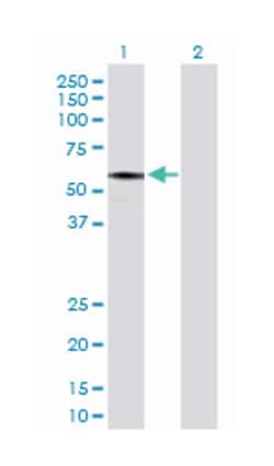 IFT57, Rabbit, Purified MaxPab Polyclonal Antibody, Abnova 100&mu;g; Unlabeled:Antibodies,