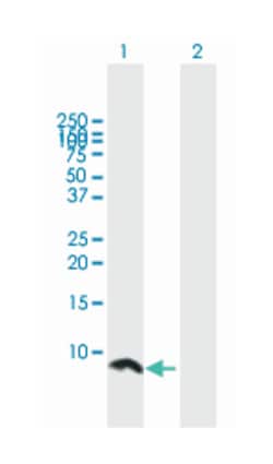 ubiquitin-conjugating enzyme E2Q family member 1, Mouse, Polyclonal Antibody,