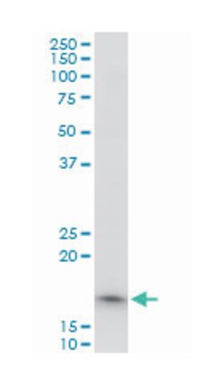 translocase of outer mitochondrial membrane 22 homolog (yeast), Mouse,