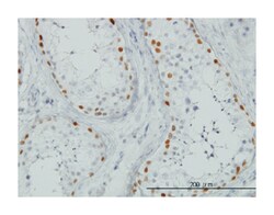 sal-like 4 (Drosophila), Mouse, Clone: 6E3, Abnova 100 &mu;g | Buy Online | Abnova Corporation | Fisher Scientific
