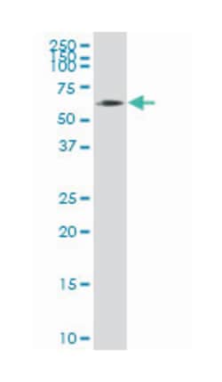 AXIN1 up-regulated 1, Mouse, Polyclonal Antibody, Abnova 50 &mu;L | Buy Online | Abnova Corporation | Fisher Scientific