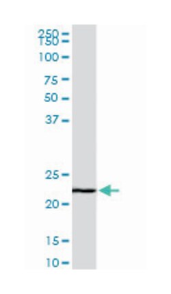 EFHD1, Mouse, Clone: 1F5, Abnova 200&mu;L; Unlabeled:Antibodies, Monoclonal