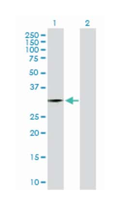 zinc finger protein 397, Rabbit, Purified MaxPab Polyclonal Antibody, Abnova 100 &mu;g | Buy Online | Abnova | Fisher Scientific