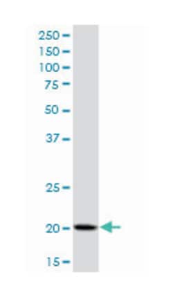 protein tyrosine phosphatase, nonreceptor type 5 (striatum-enriched), Mouse,