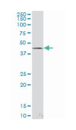 LIM homeobox 4, Mouse, Clone: 4D7, Abnova 100 &mu;g | Buy Online | Abnova | Fisher Scientific