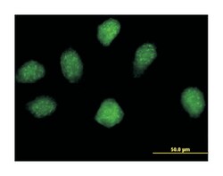 exoribonuclease 2, Mouse, Purified MaxPab Polyclonal Antibody, Abnova 50&mu;g;