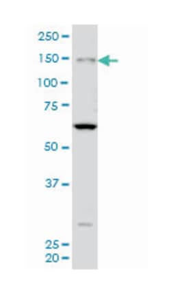myosin IIIA, Mouse, Clone: 8H2, Abnova 50&mu;g; Unlabeled:Antibodies, Monoclonal