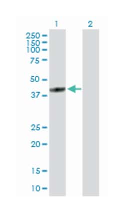 F-box and leucine-rich repeat protein 8, Rabbit, Purified MaxPab Polyclonal Antibody, Abnova 100 &mu;g | Buy Online | Abnova | Fisher Scientific