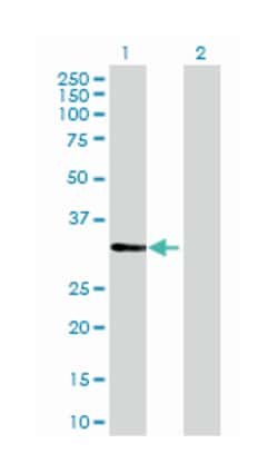 CDV3 homolog (mouse), Mouse, MaxPab Polyclonal Antibody, Abnova 50&mu;L;