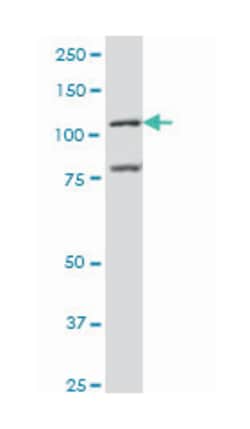 BMP2 inducible kinase, Mouse, Clone: 1F11, Abnova 100 &mu;g | Buy Online | Abnova Corporation | Fisher Scientific