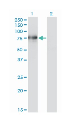 BMP2 inducible kinase, Mouse, Clone: 1F11, Abnova 100 &mu;g | Buy Online | Abnova Corporation | Fisher Scientific