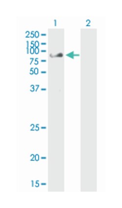 checkpoint with forkhead and ring finger domains, Mouse, Clone: 1H3-A12,