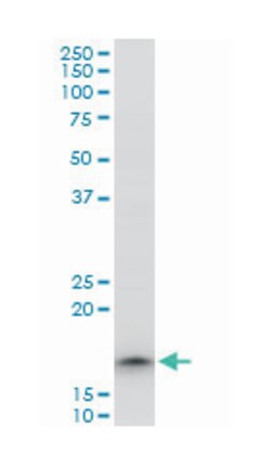 translocase of outer mitochondrial membrane 22 homolog (yeast), Mouse,