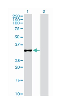 ChGn (B02P), Mouse anti-Human, Purified MaxPab Polyclonal Antibody, Abnova 50 &mu;g | Buy Online | Abnova | Fisher Scientific