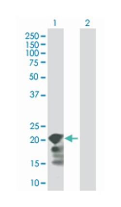 selenoprotein S (B01), Mouse anti-Human, Polyclonal Antibody, Abnova 50μL;