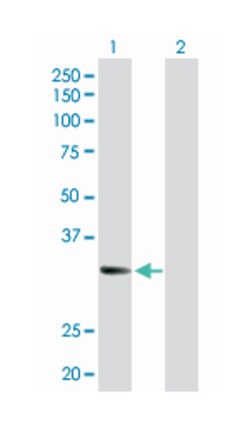 centromere protein J, Rabbit, Purified MaxPab Polyclonal Antibody, Abnova